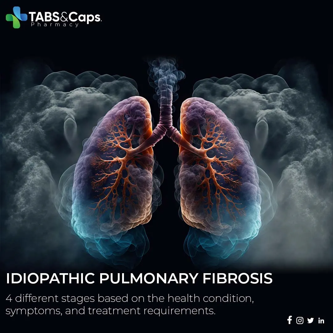 What-are-the-4-Stages-of-IPF?